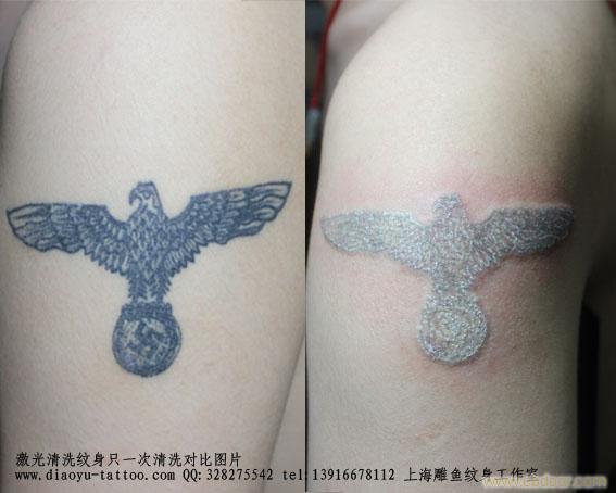 上海闵行区清洗纹身哪里好 地址 价格