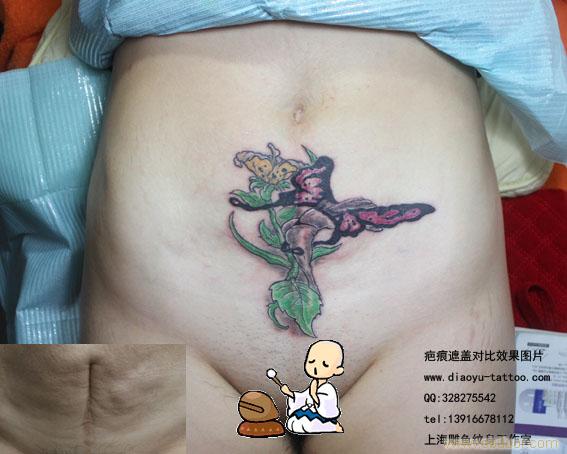 上海哪里有遮盖疤痕的纹身店_上海哪里有遮盖