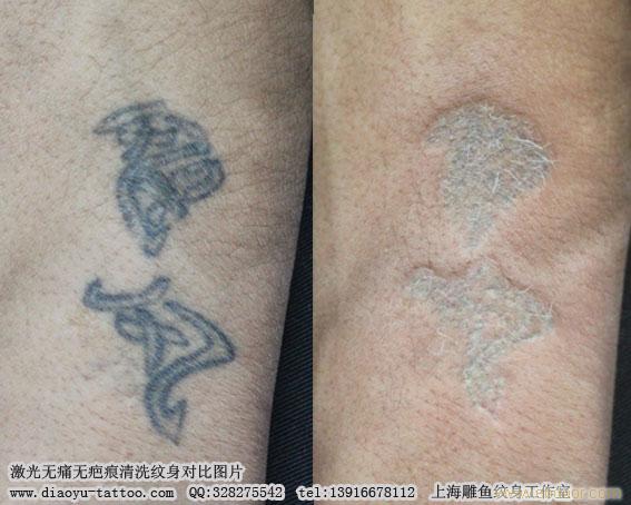 上海洗纹身哪里洗的比较好而且价格不贵