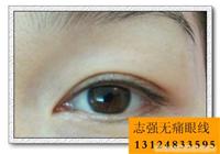 上海无痛纹眼线专家