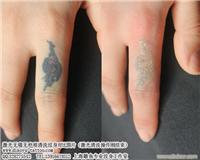 上海杨浦区纹身洗纹身哪里做的比较好 而且价格还不贵