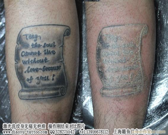 上海洗纹身哪里-洗纹身需要多少钱