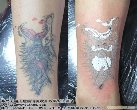 上海洗纹身 上海洗纹身店 上海洗纹身价格 上海专业洗纹身