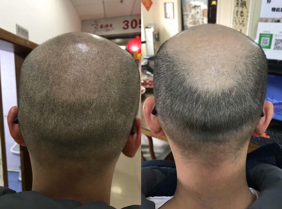 上海专业纹发店?