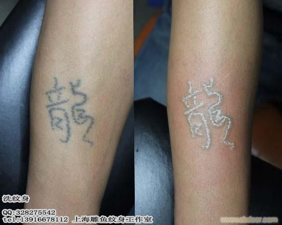 上海漕宝路附近哪里有专业洗纹身的地方