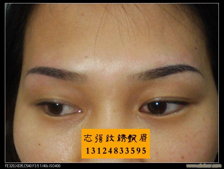 绣眉一般要多少钱