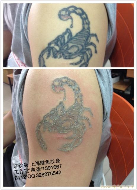 上海闵行区吴中路专业洗纹身店