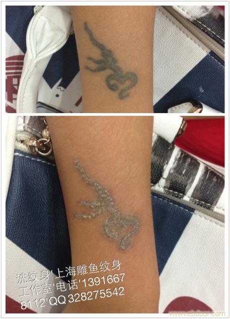 上海徐汇区专业洗纹身店--上海雕鱼纹身工作室