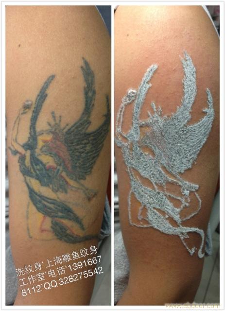 上海市徐汇区桂林路专业洗纹身店