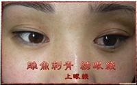 上海专业纹眼线 