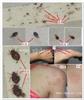 番禺杀臭虫工厂宿舍有臭虫要怎么杀