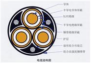 35KV 