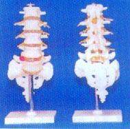 大型腰椎带骶骨尾骨椎间盘突出的教学模型（人体解剖模型、解剖模型、医学模型、骨骼模型） 