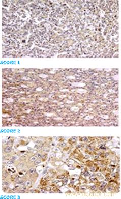Hepa-Ab免疫组化试剂盒 
