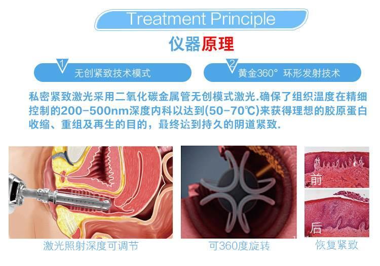 欣姿美容点阵激光贵吗