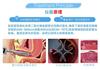 欣姿点阵激光前后图片 铒激光是点阵激光吗