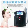 美容院皮秒激光效果，皮秒的价格是多少，欣姿超皮秒厂家