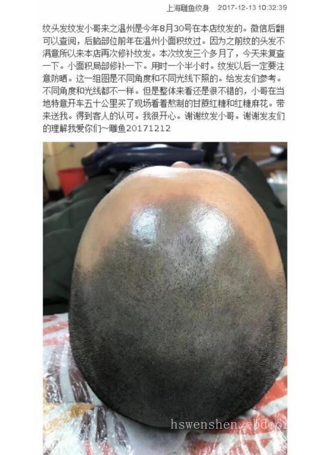 纹发一年半以后效果怎么样