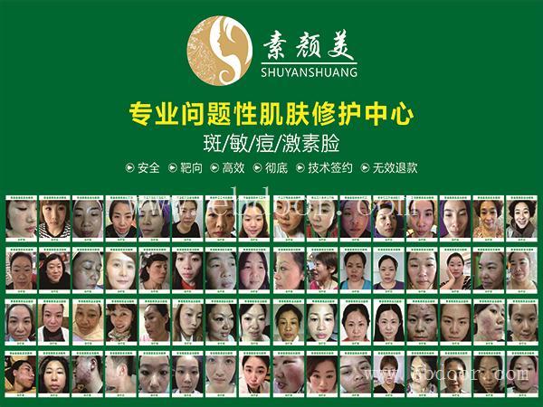 长春素颜美祛斑加盟合作