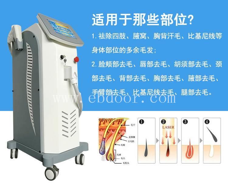 欣姿激光脱毛仪价格 冰点脱毛仪器厂家