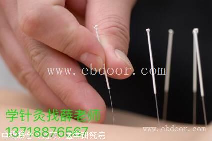 针灸培训学校 针灸治疗疼痛 中风偏瘫