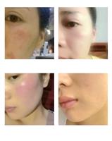 980净丝仪定制 980净丝仪配置参数表