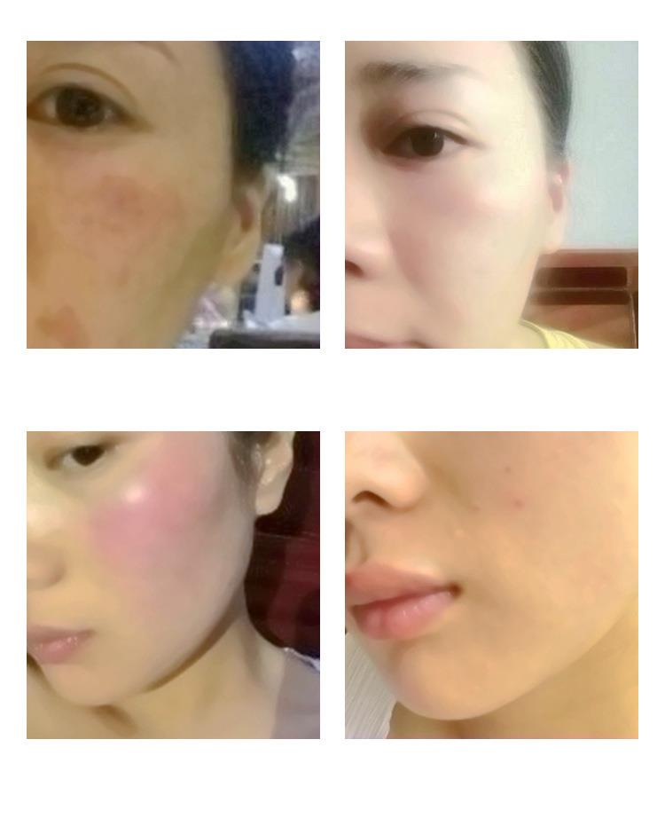 980净丝仪定制 980净丝仪配置参数表