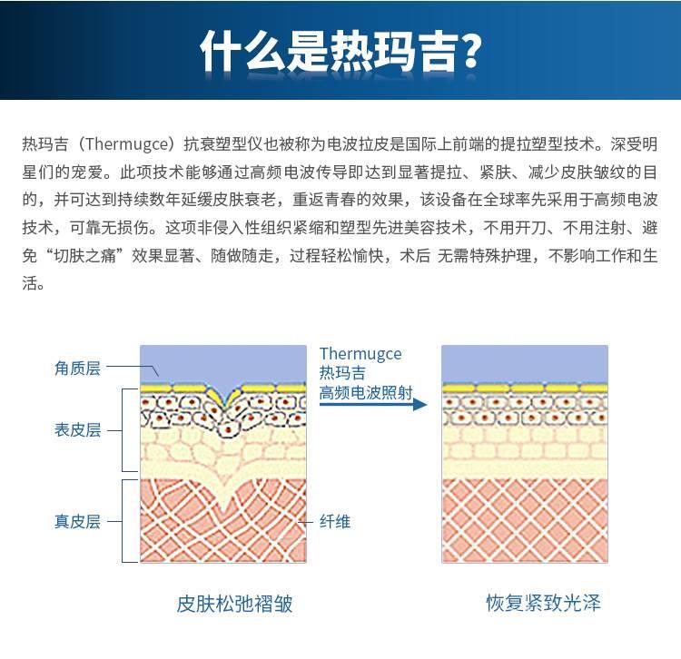 热玛吉多少钱一台 热玛吉5代订制