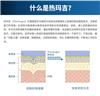 热玛吉抗衰仪使用方法 减轻颈纹 第五代热玛吉生产商