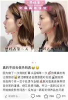 热玛吉5代做一次多少钱 热玛吉5代