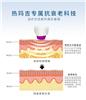 祛皱抗衰热玛吉抗衰能保持多久