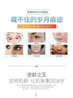 全身抗衰老热玛吉抗衰仪厂家供应