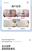 美容院点阵激光仪器品牌比较 点阵激光治疗仪销售电话
