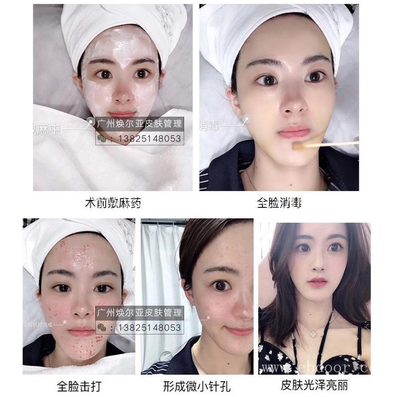 德玛莎水光仪广州厂家直销