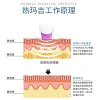 美容院用热玛吉有副作用吗 热玛吉五代原理及功效