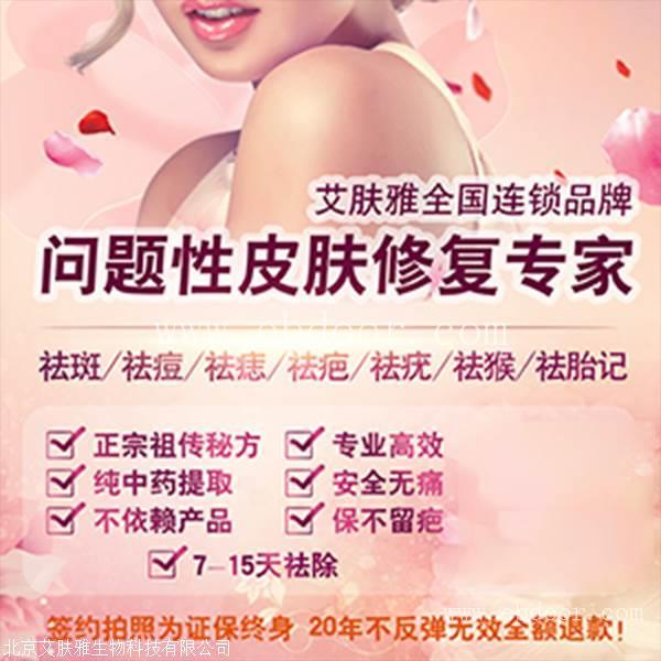 祛斑加盟品牌广告