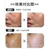 .超皮秒原理及功效 755蜂巢皮秒激光生产商 皮秒品牌好