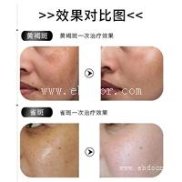 .超皮秒原理及功效 755蜂巢皮秒激光生产商 皮秒品牌好