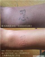 上海闵行区梅陇附近激光清洗纹身哪里最专业纹身价格具体地址